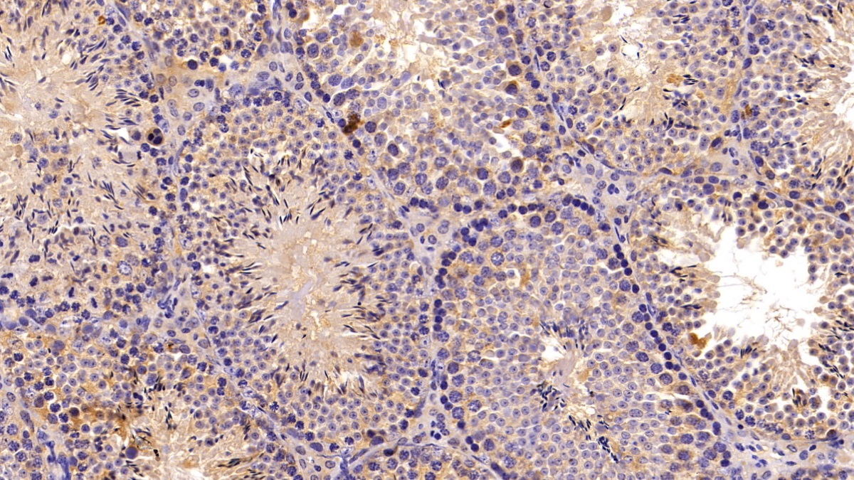 补体C3转化酶(C3 Convertase)多克隆抗体