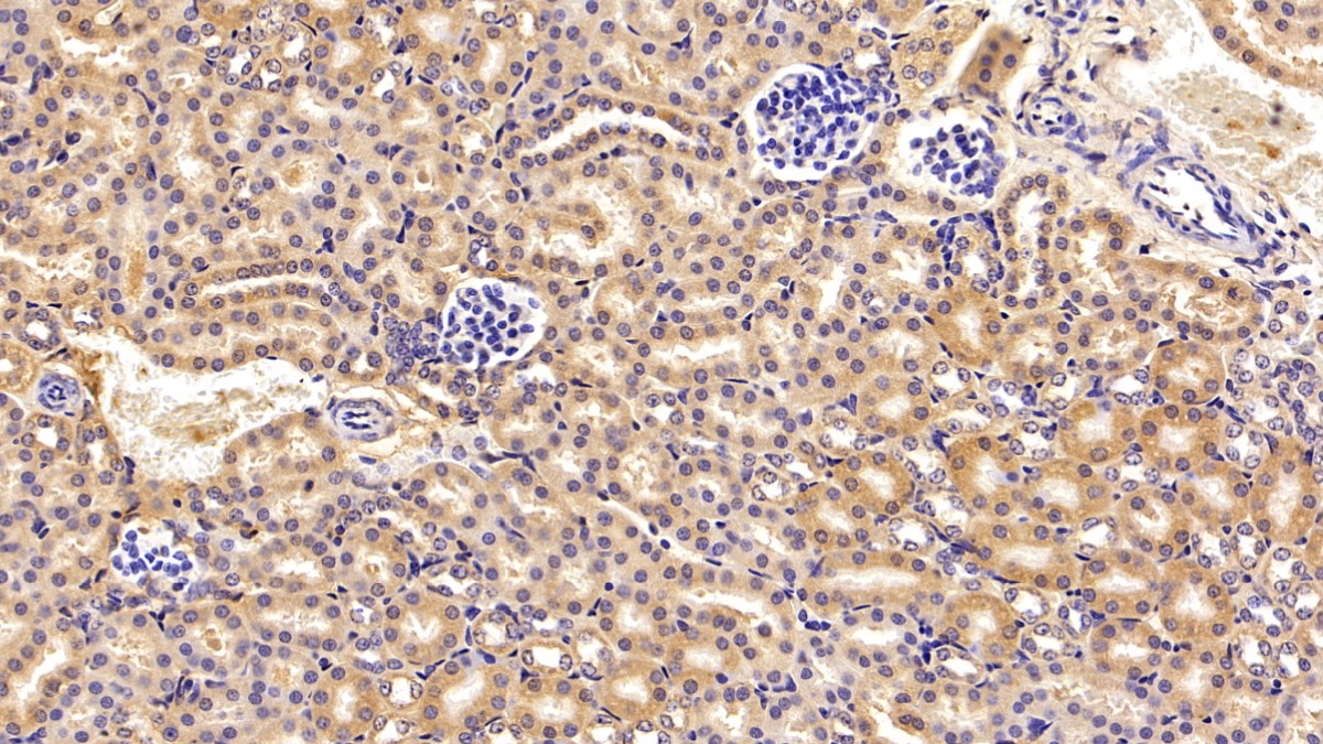 补体C3转化酶(C3 Convertase)多克隆抗体