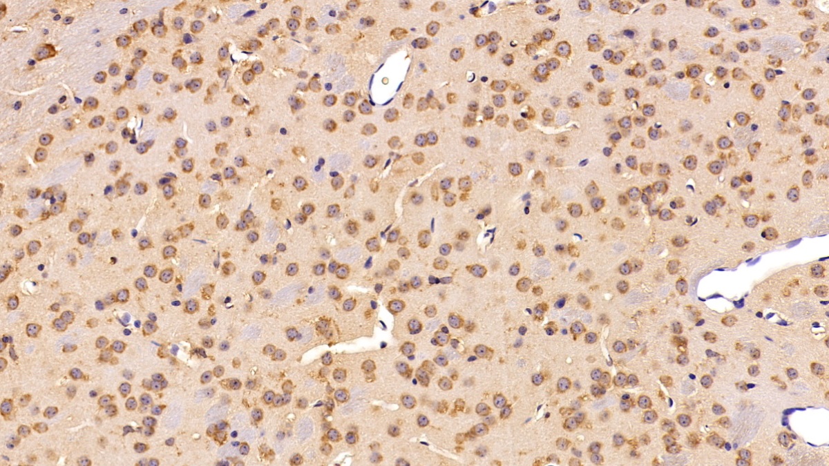 补体C3转化酶(C3 Convertase)多克隆抗体