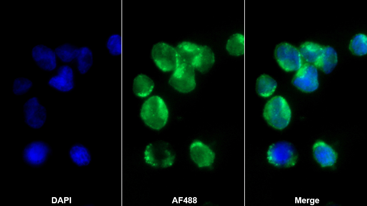 乳鐵傳遞蛋白(LTF)多克隆抗體
