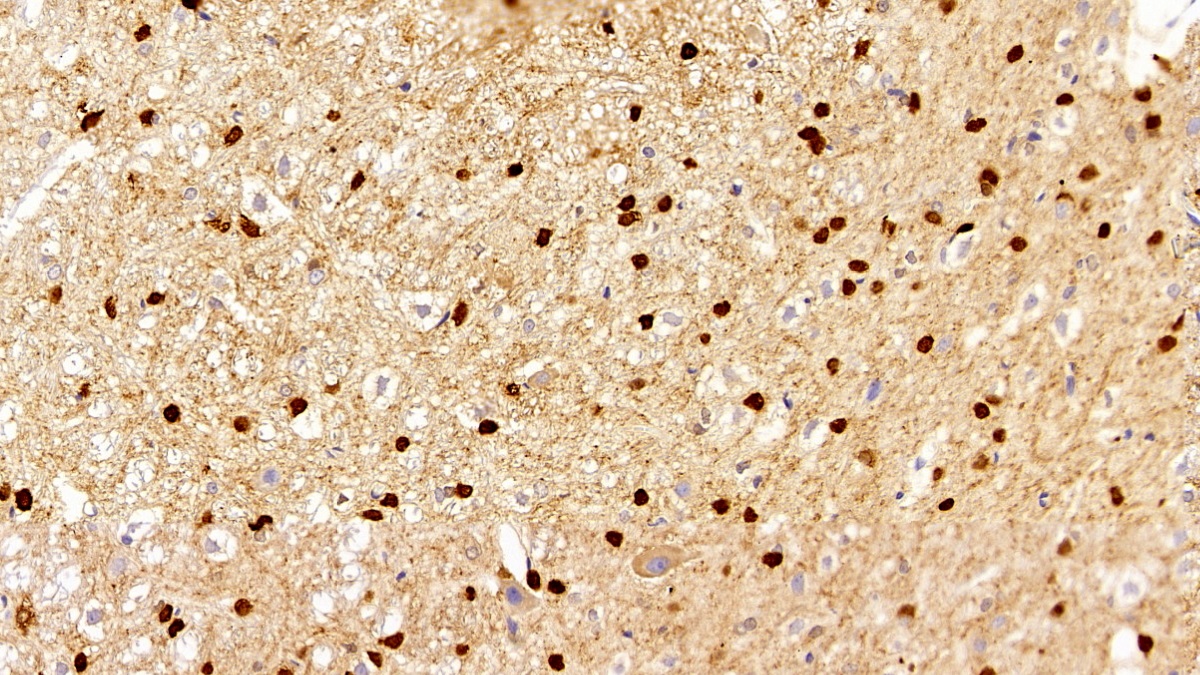 碳酸酐酶Ⅱ(CA2)多克隆抗体