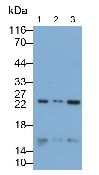 周期素依赖性激酶抑制因子2A(CDKN2A)多克隆抗体
