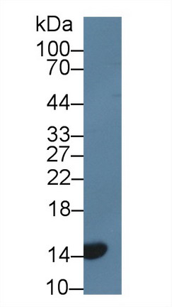 周期素依賴性激酶抑制因子2A(CDKN2A)多克隆抗體
