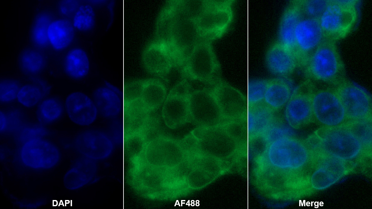 血管紧张素原(AGT)多克隆抗体