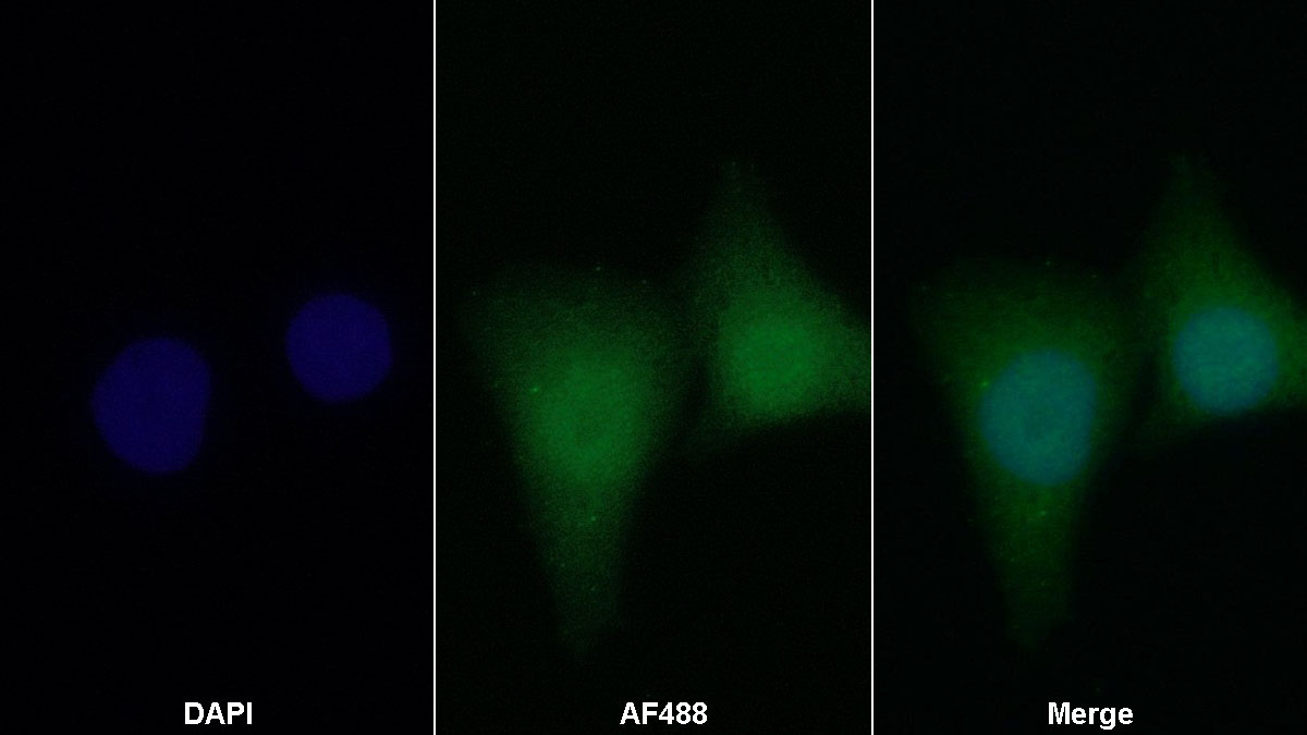 低氧诱导因子1α(HIF1a)多克隆抗体