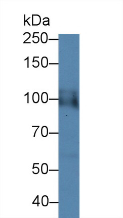 低氧诱导因子1α(HIF1a)多克隆抗体