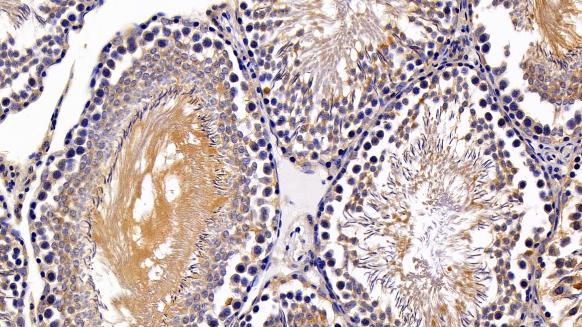低氧诱导因子1α(HIF1a)多克隆抗体