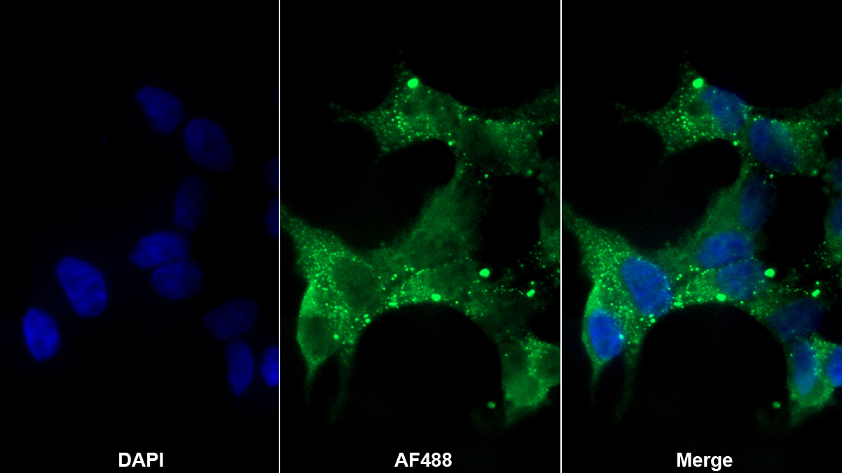 神經(jīng)型一氧化氮合酶(NOS1)多克隆抗體
