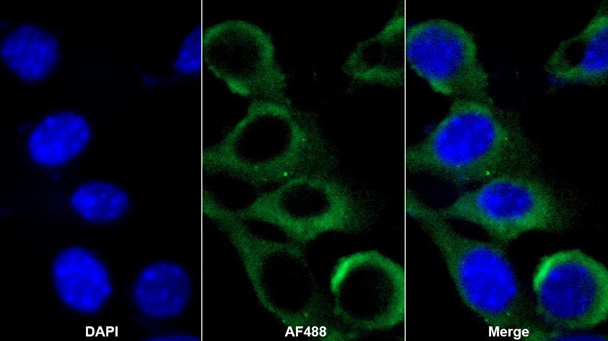 α1-酸性糖蛋白(a1AGP)多克隆抗體