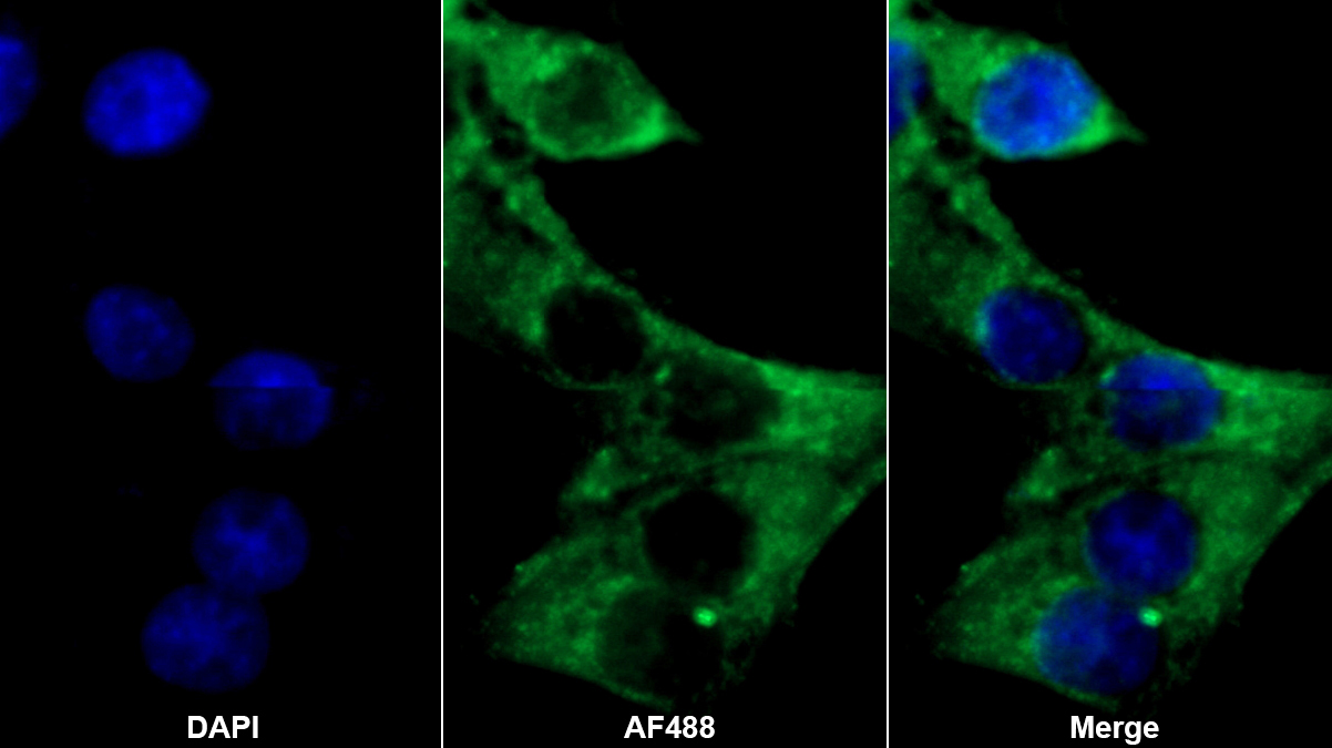 結(jié)合珠蛋白(Hpt)多克隆抗體