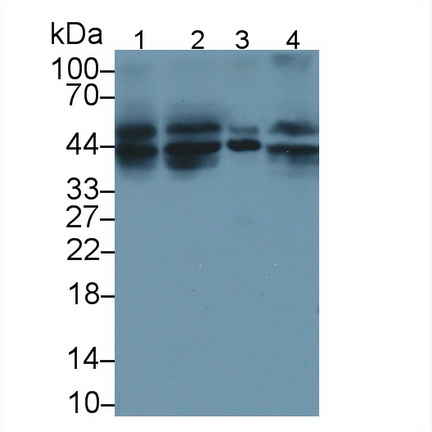 死亡受體5(DR5)多克隆抗體