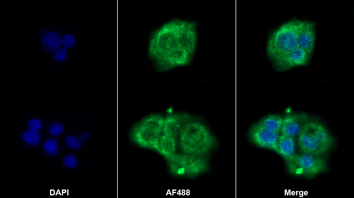凝血因子Ⅱ(F2)多克隆抗体