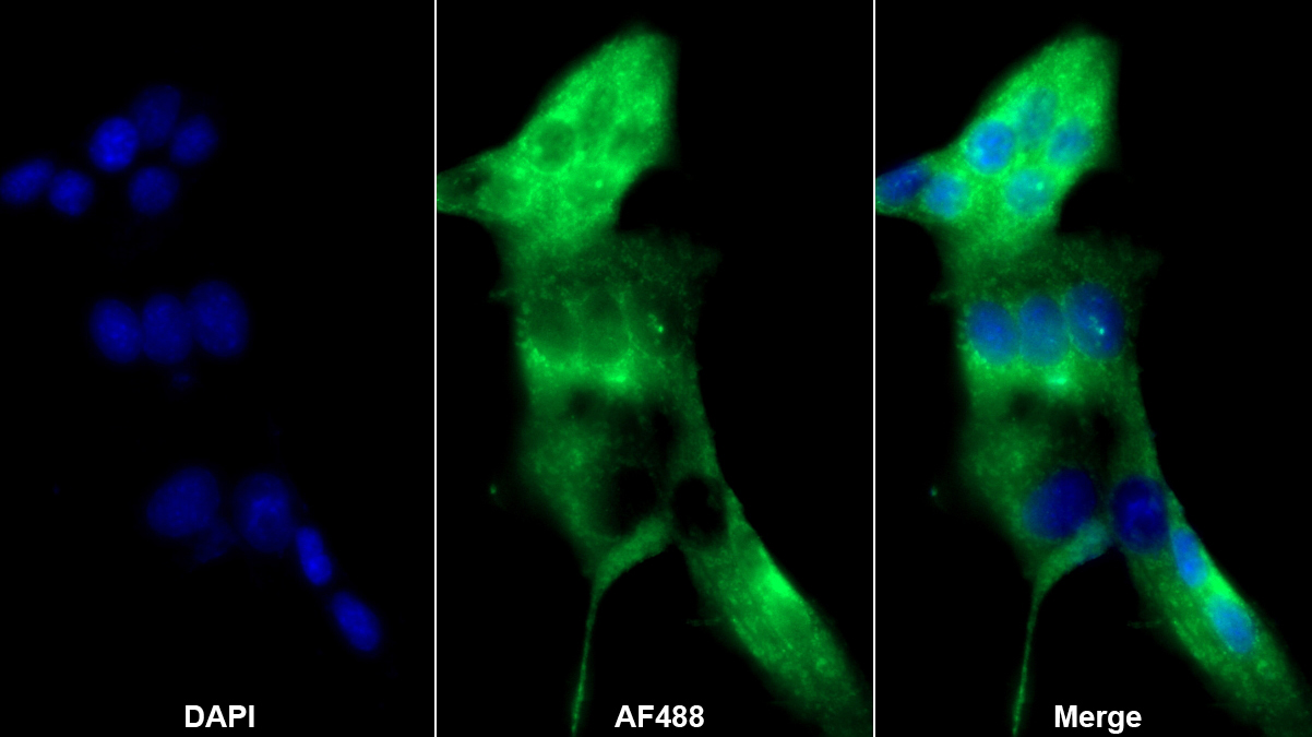 凝血因子Ⅱ(F2)多克隆抗體