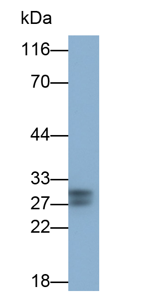 C反應(yīng)蛋白(CRP)多克隆抗體