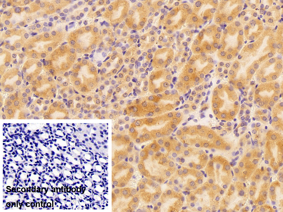 90kDa熱休克蛋白β1(HSP90b1)多克隆抗體