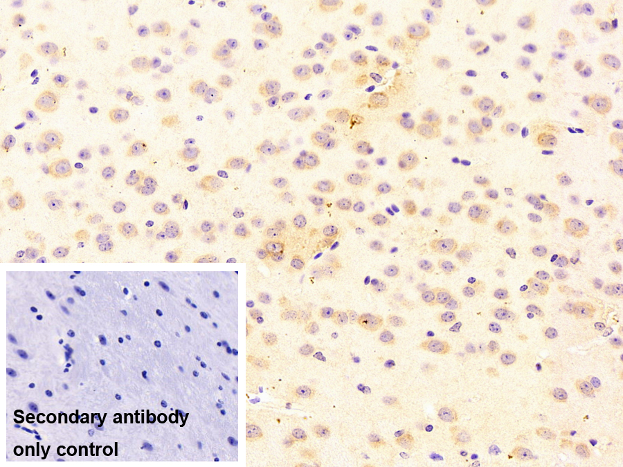 90kDa熱休克蛋白β1(HSP90b1)多克隆抗體