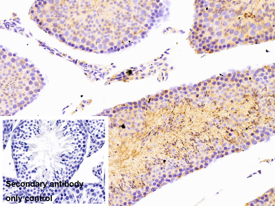 90kDa熱休克蛋白β1(HSP90b1)多克隆抗體