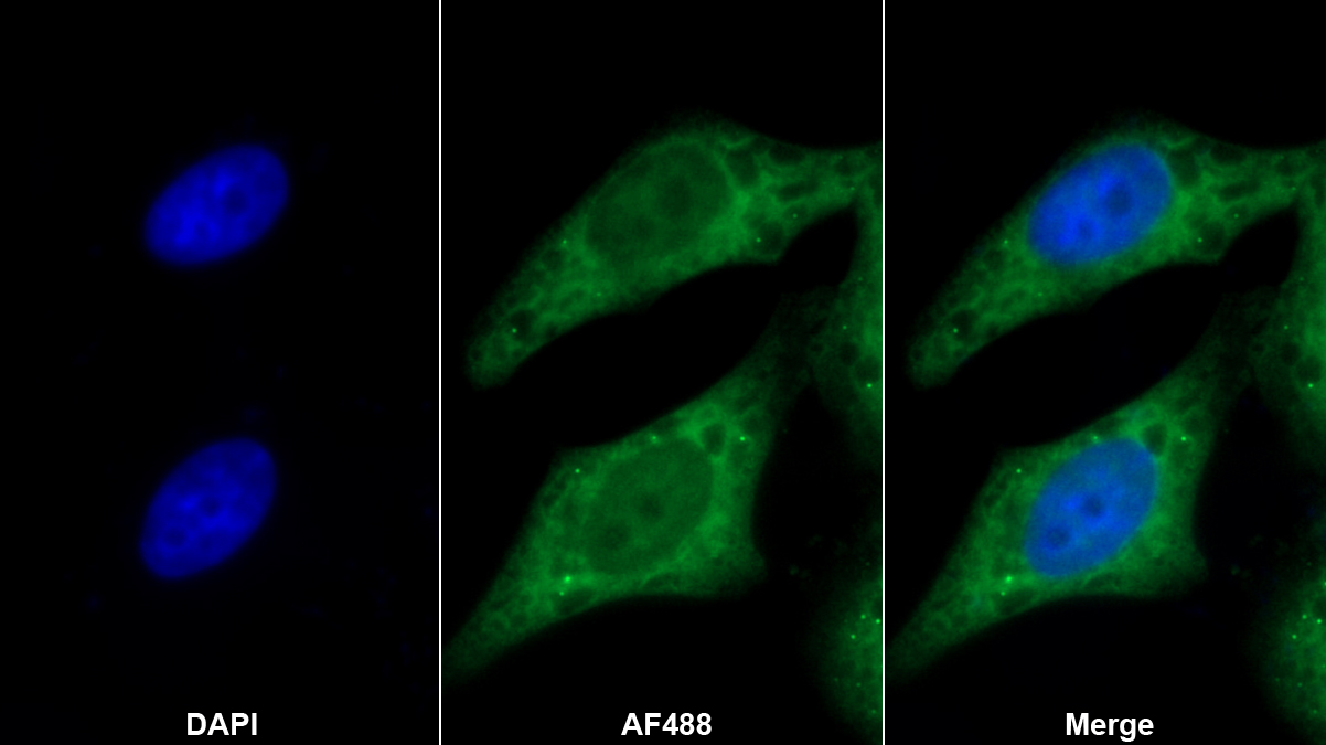 90kDa熱休克蛋白β1(HSP90b1)多克隆抗體