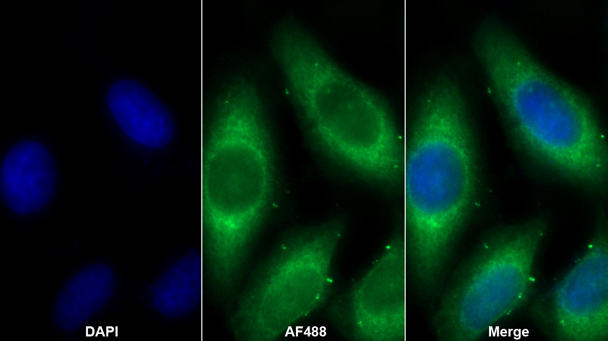 90kDa熱休克蛋白β1(HSP90b1)多克隆抗體