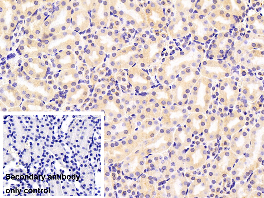 90kDa熱休克蛋白β1(HSP90b1)多克隆抗體