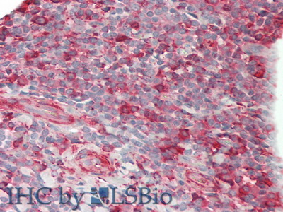 CD86分子(CD86)多克隆抗体