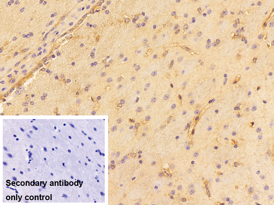 凝血酶/抗凝血酶復合體(TAT)多克隆抗體