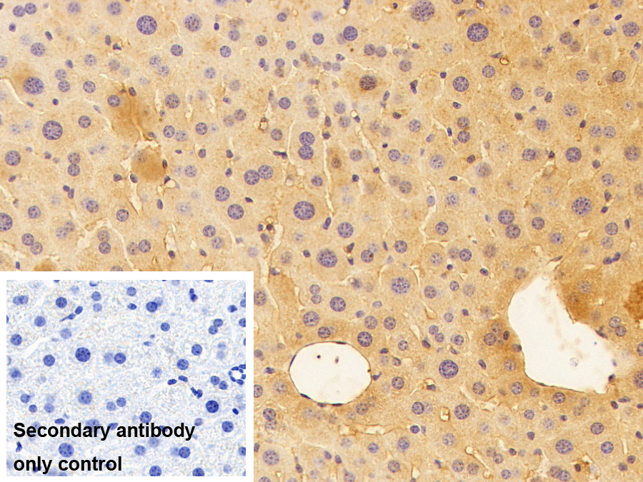 凝血酶/抗凝血酶復合體(TAT)多克隆抗體
