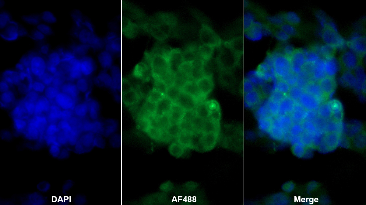 血管性血友病因子(vWF)多克隆抗體
