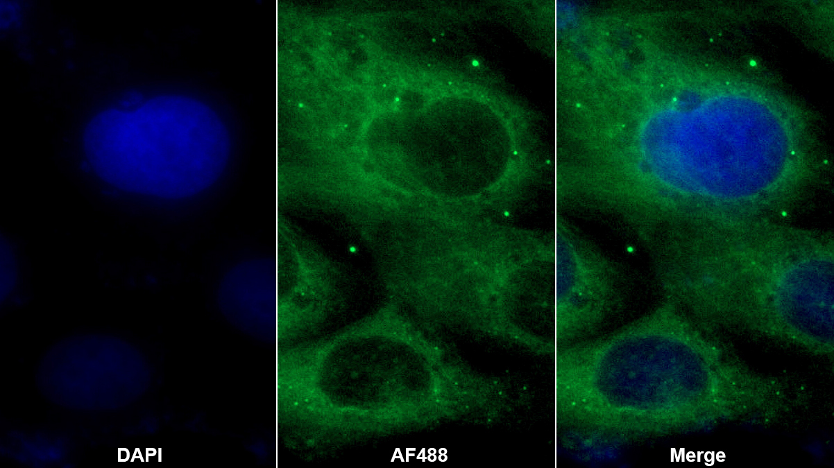 誘導(dǎo)型一氧化氮合酶(NOS2)多克隆抗體