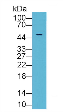 抑制素βA(INHbA)多克隆抗體