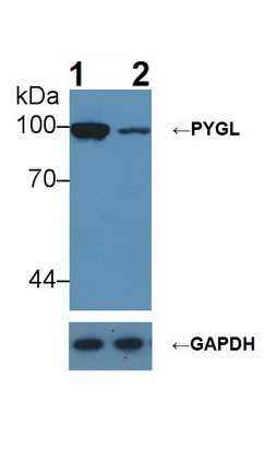 糖原磷酸化酶L(PYGL)多克隆抗體