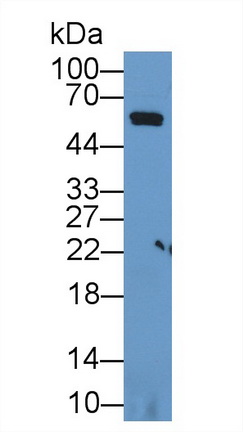 胱天蛋白酶8(CASP8)多克隆抗体