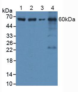胱天蛋白酶8(CASP8)多克隆抗体