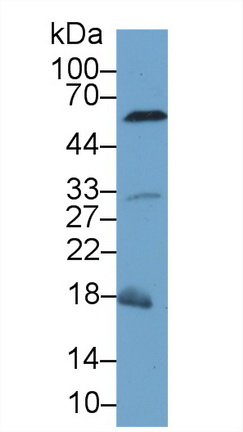 胱天蛋白酶8(CASP8)多克隆抗體