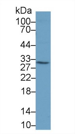 胱天蛋白酶8(CASP8)多克隆抗體