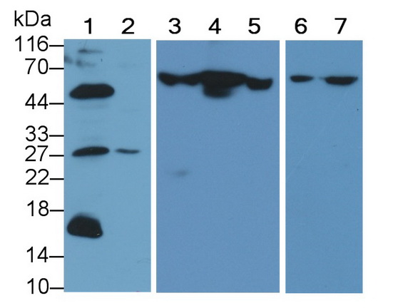 胱天蛋白酶8(CASP8)多克隆抗體