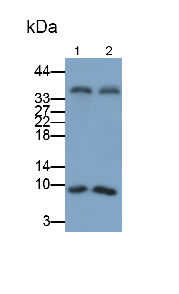 甲状旁腺激素(PTH)多克隆抗体