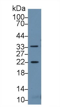热休克蛋白β2(HSPb2)多克隆抗体