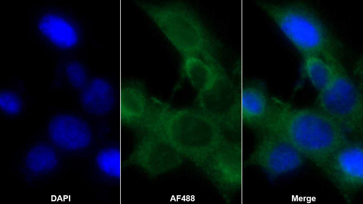 血清淀粉樣蛋白A(SAA)多克隆抗體