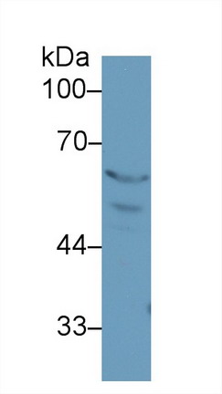 過(guò)氧化物酶體增殖物激活受體γ(PPARg)多克隆抗體