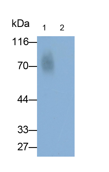 β-骨膠原交聯(lián)(bCTx)多克隆抗體
