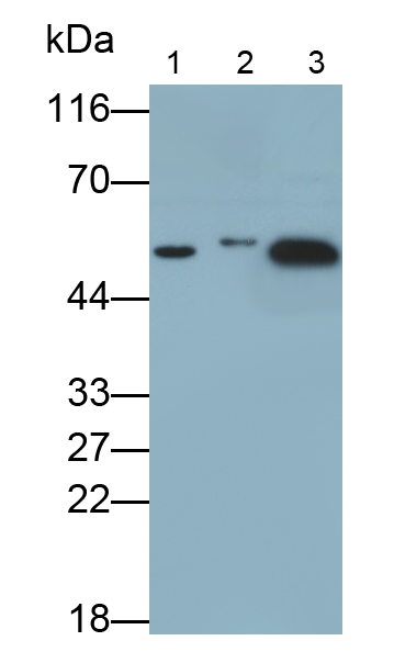 腫瘤蛋白p53(P53)多克隆抗體