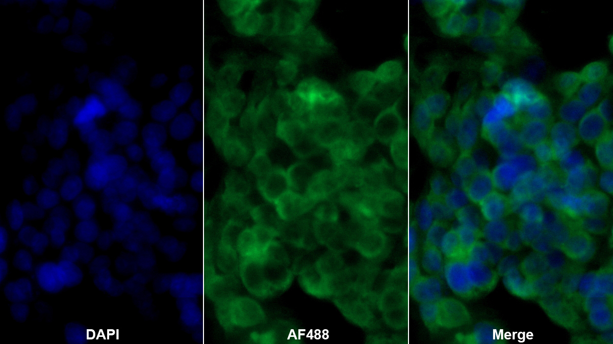 視黃醇結(jié)合蛋白4(RBP4)多克隆抗體