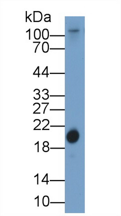 视黄醇结合蛋白4(RBP4)多克隆抗体