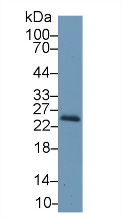 视黄醇结合蛋白4(RBP4)多克隆抗体