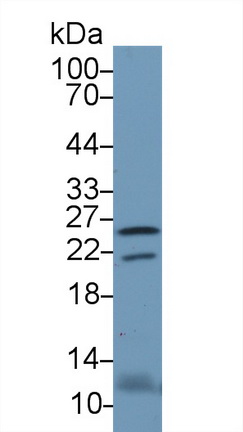 视黄醇结合蛋白4(RBP4)多克隆抗体