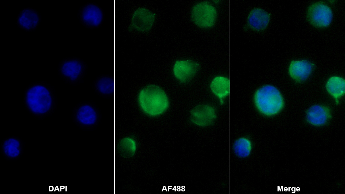 内凝集蛋白1(ITLN1)多克隆抗体