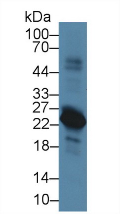 前-B-淋巴细胞基因1(VPREB1)多克隆抗体