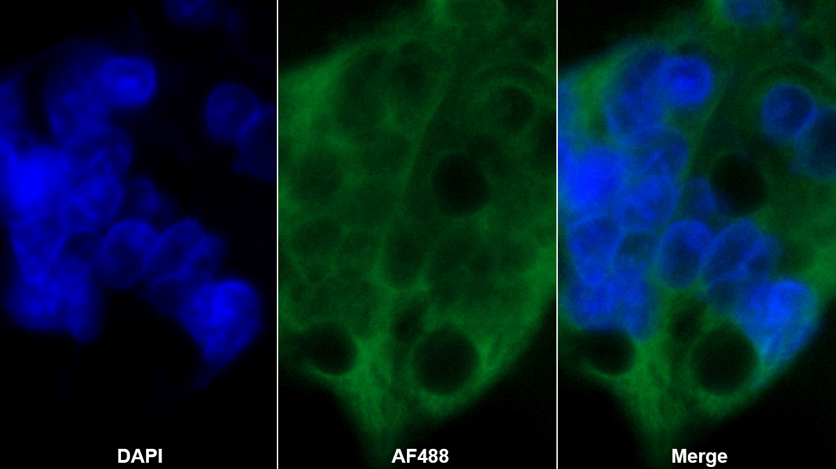 趋化素(CHEM)多克隆抗体