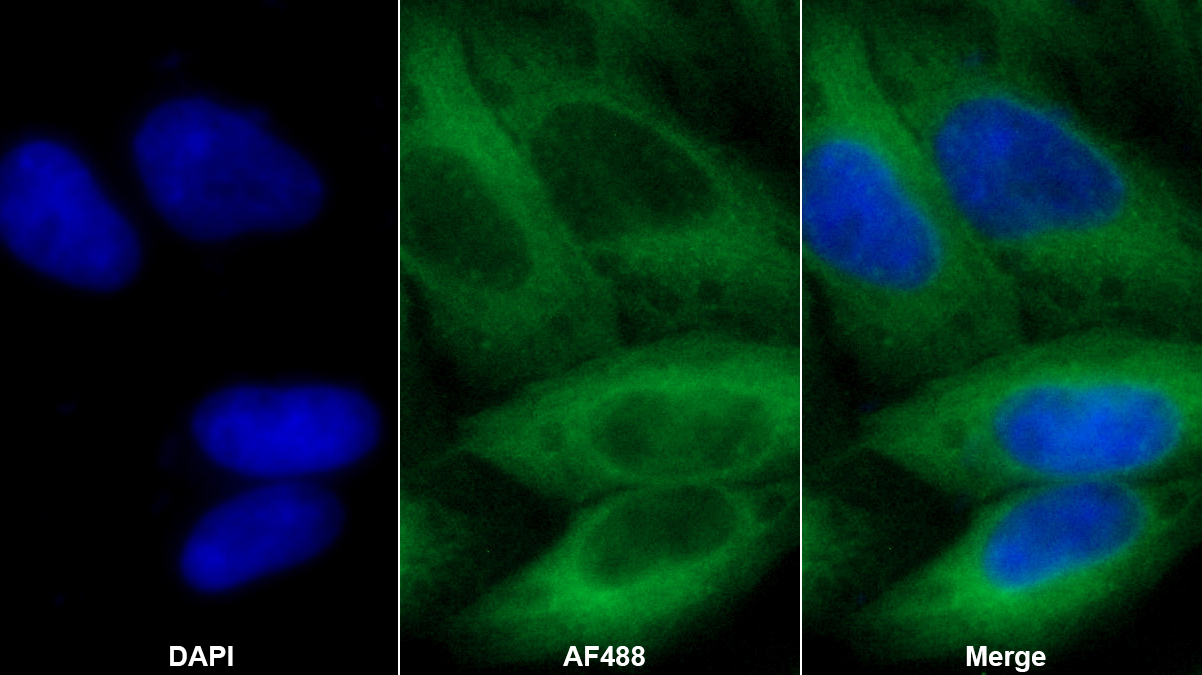 胸腺嘧啶核苷磷酸化酶(TP)多克隆抗體